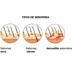 tipos de seborrea en perros y gatos
