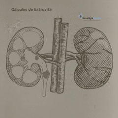 cristales de estruvita en los perros Lenda Vet Urinary-Struvite